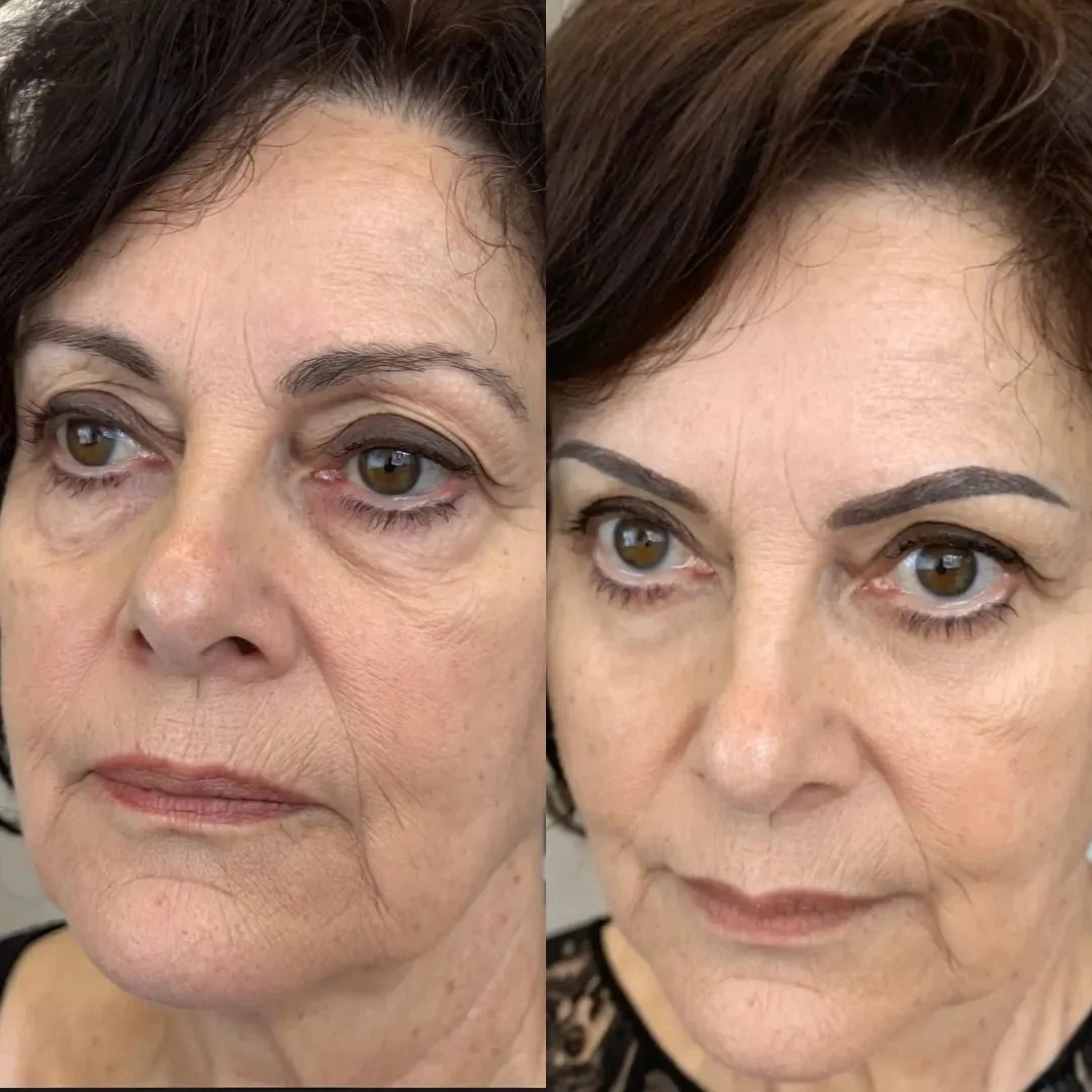 RevitalEyes® 2-in-1 Red Light Therapy + EMS To Erase Eye Bags - Image 5