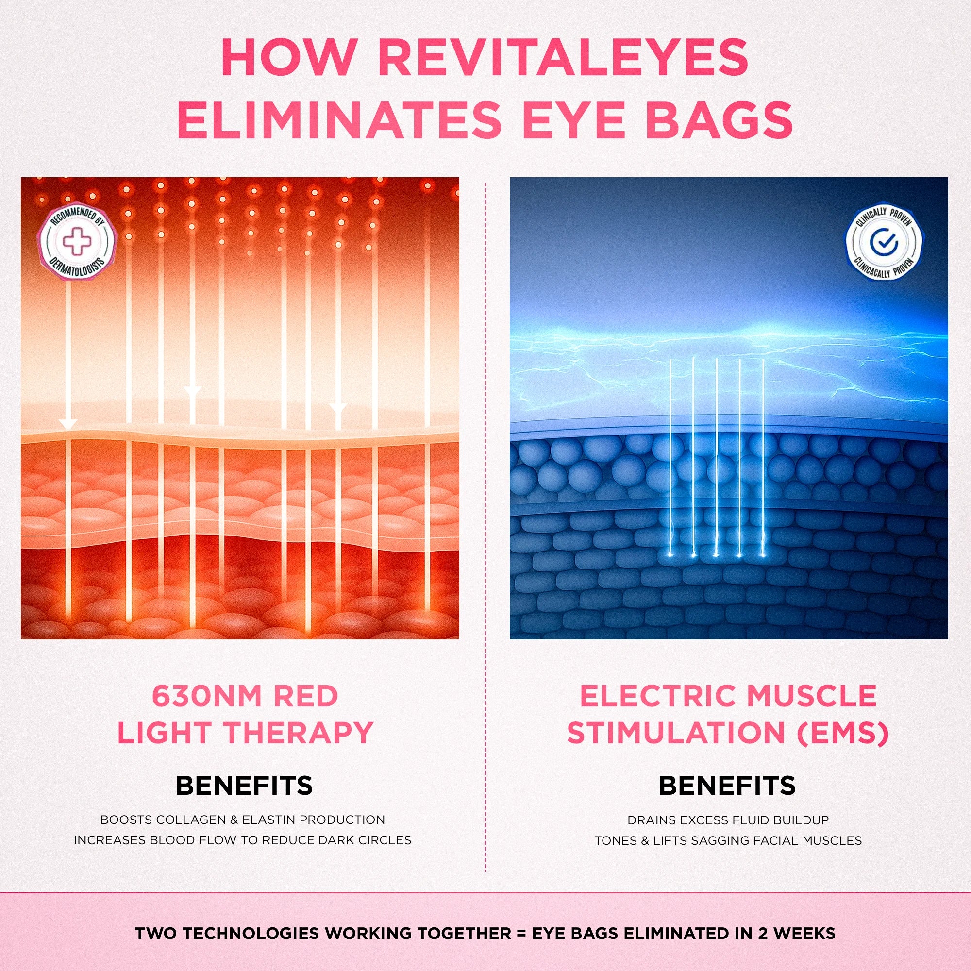 RevitalEyes® 2-in-1 Red Light Therapy + EMS To Erase Eye Bags - Image 7