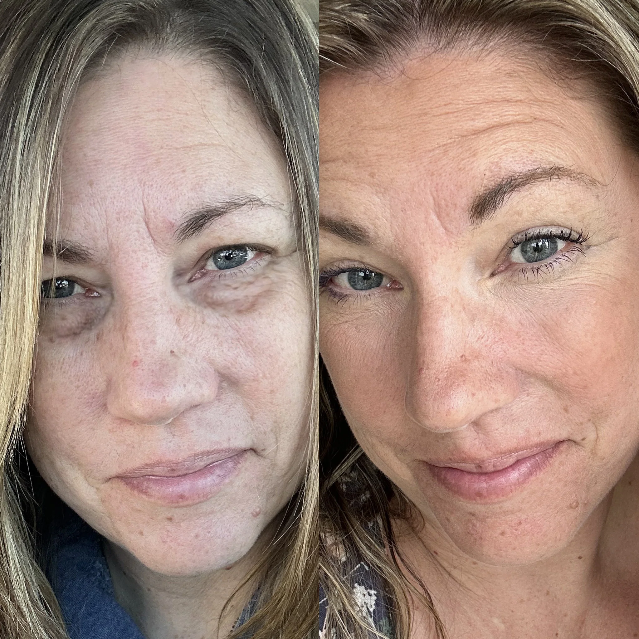 RevitalEyes®  2-in-1 Red Light + EMS Under-Eye Therapy - Image 5